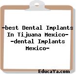 «best Dental Implants In Tijuana Mexico» «dental Implants Mexico»